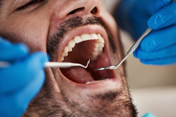 Best Chipped Tooth Repair Near Me  in Greenback, TN